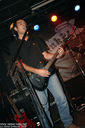 ciroza_jetre-11.jpg