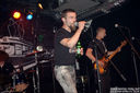 ciroza_jetre-12.jpg