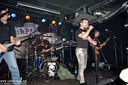 ciroza_jetre-4.jpg