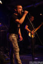ciroza_jetre-6.jpg