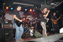 ciroza_jetre-7.jpg