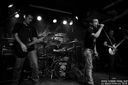ciroza_jetre-9.jpg